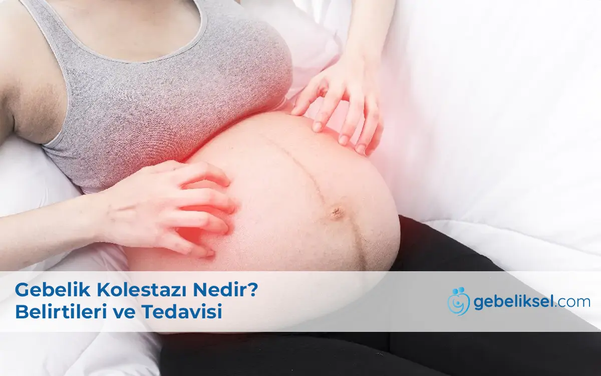 Gebelik Kolestazı​ Nedir?