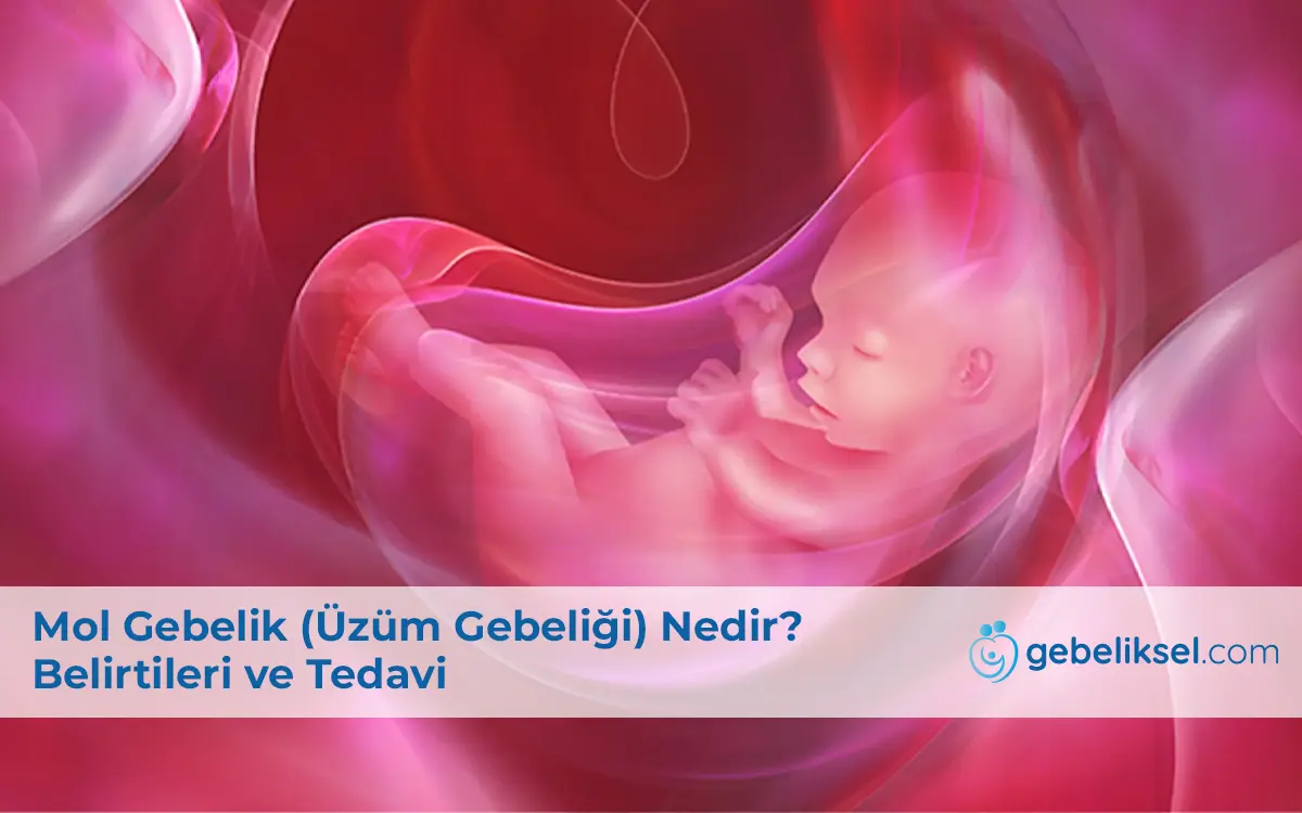 Mol Gebelik (Üzüm Gebeliği) Nedir?